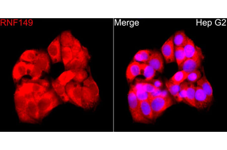 Immunofluorescence - Anti-RNF149 Antibody (A329811) - Antibodies.com