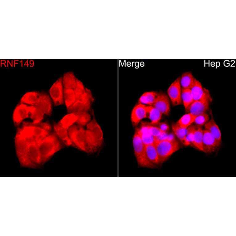 Immunofluorescence - Anti-RNF149 Antibody (A329811) - Antibodies.com