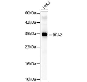 Western Blot - Anti-RPA2 Antibody (A329813) - Antibodies.com