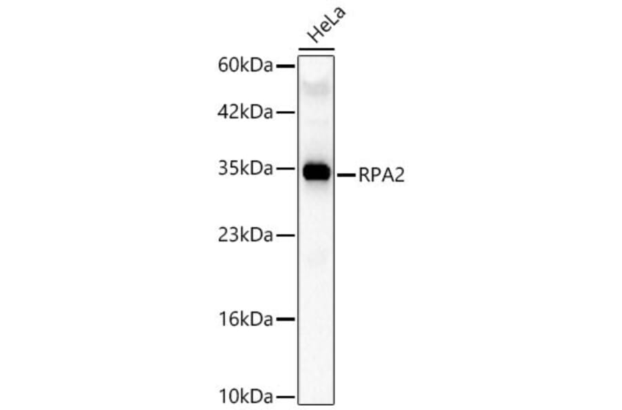 Western Blot - Anti-RPA2 Antibody (A329813) - Antibodies.com