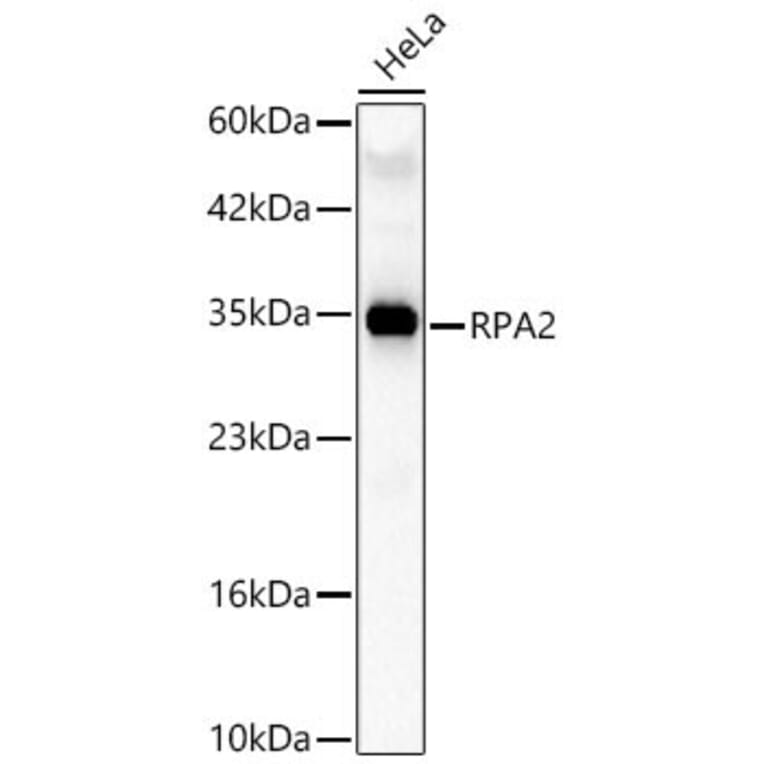 Western Blot - Anti-RPA2 Antibody (A329813) - Antibodies.com