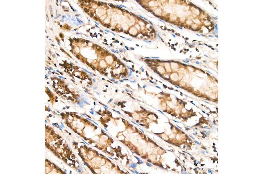 Immunohistochemistry - Anti-RPA2 Antibody (A329813) - Antibodies.com