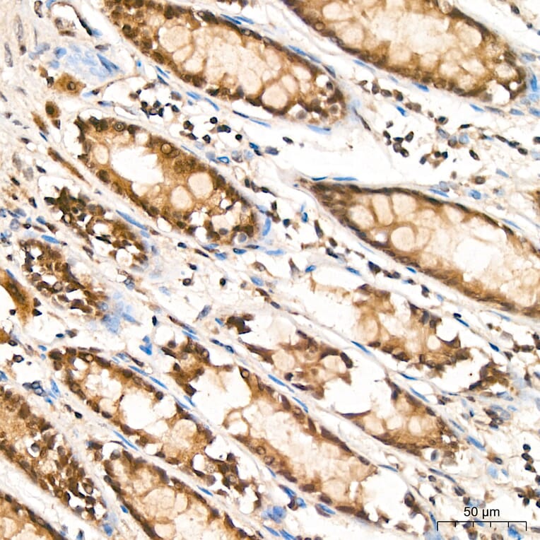Immunohistochemistry - Anti-RPA2 Antibody (A329813) - Antibodies.com