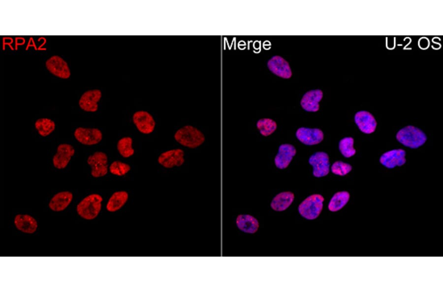 Immunofluorescence - Anti-RPA2 Antibody (A329813) - Antibodies.com