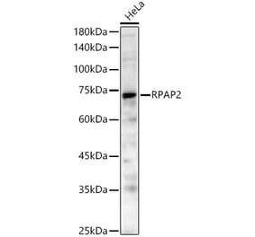Western Blot - Anti-RPAP2 Antibody (A329814) - Antibodies.com