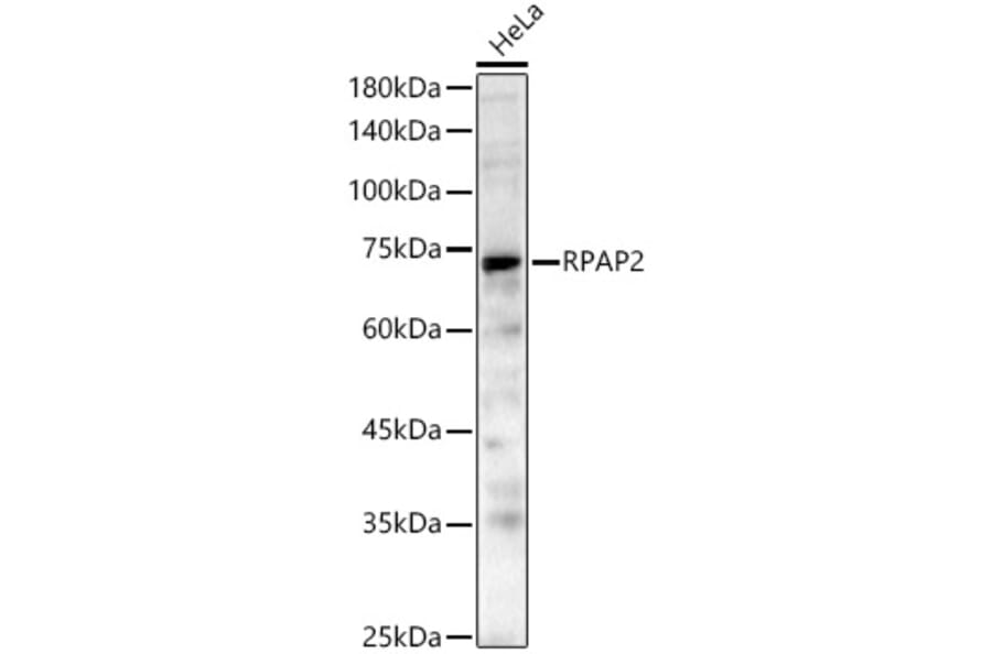 Western Blot - Anti-RPAP2 Antibody (A329814) - Antibodies.com