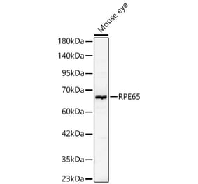 Western Blot - Anti-RPE65 Antibody (A329815) - Antibodies.com