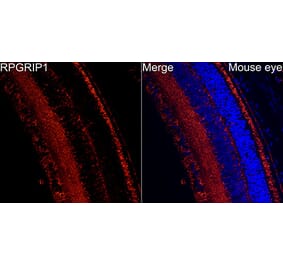 Immunofluorescence - Anti-RPGRIP1 Antibody (A329816) - Antibodies.com