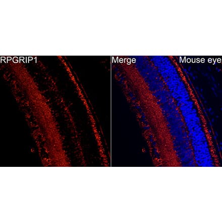 Immunofluorescence - Anti-RPGRIP1 Antibody (A329816) - Antibodies.com