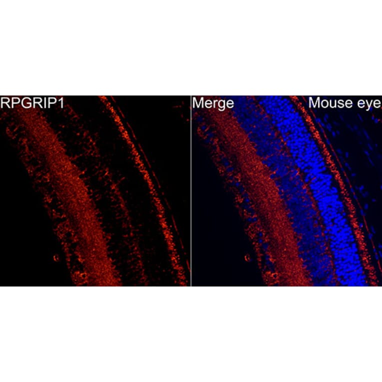 Immunofluorescence - Anti-RPGRIP1 Antibody (A329816) - Antibodies.com