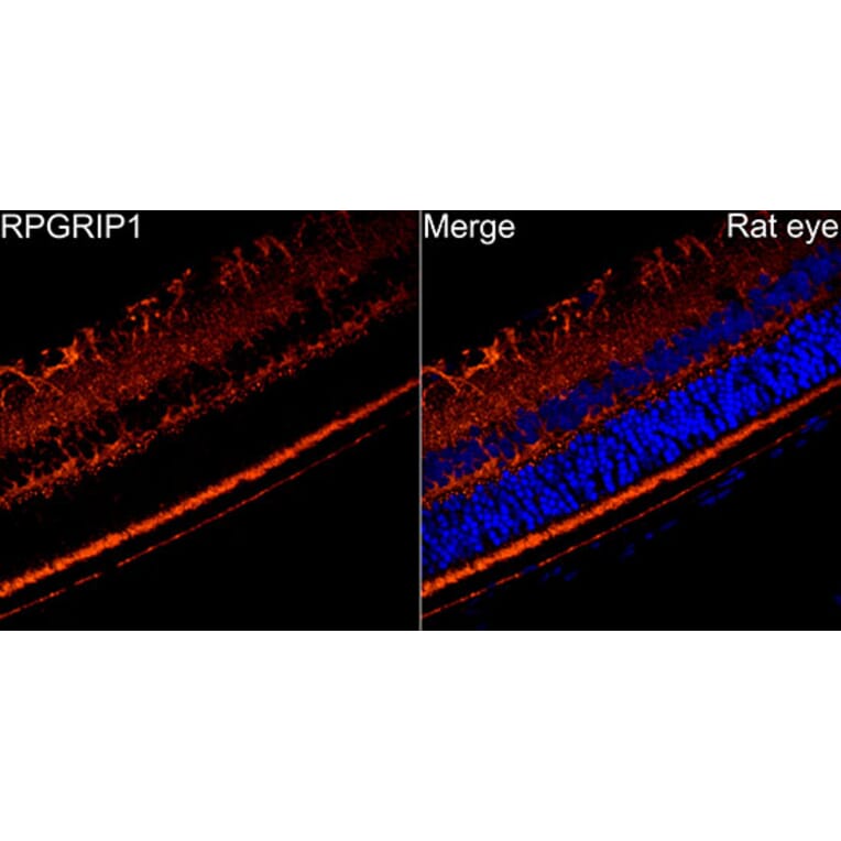 Immunofluorescence - Anti-RPGRIP1 Antibody (A329816) - Antibodies.com