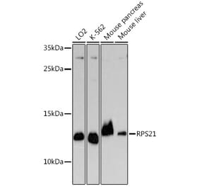 Western Blot - Anti-RPS21 Antibody (A329817) - Antibodies.com