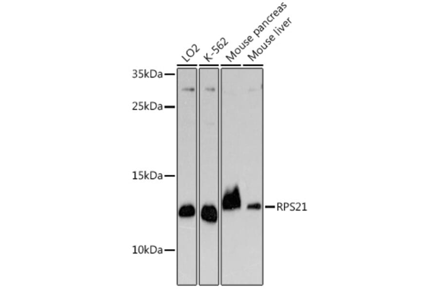 Western Blot - Anti-RPS21 Antibody (A329817) - Antibodies.com