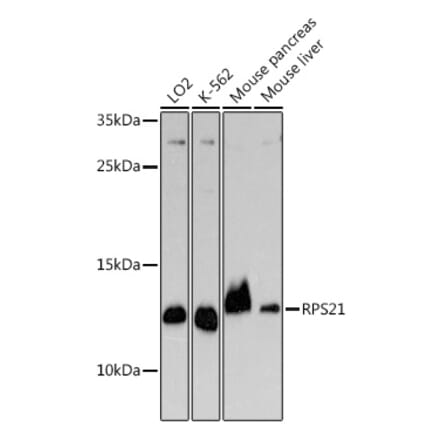 Western Blot - Anti-RPS21 Antibody (A329817) - Antibodies.com