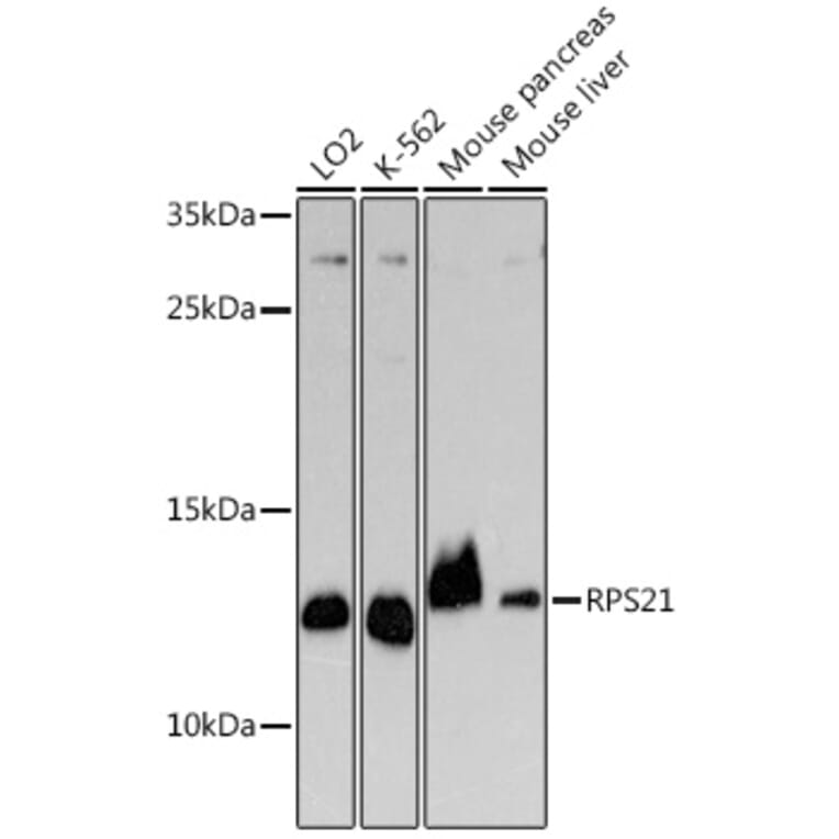 Western Blot - Anti-RPS21 Antibody (A329817) - Antibodies.com