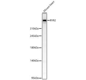 Western Blot - Anti-RYR2 Antibody (A329818) - Antibodies.com