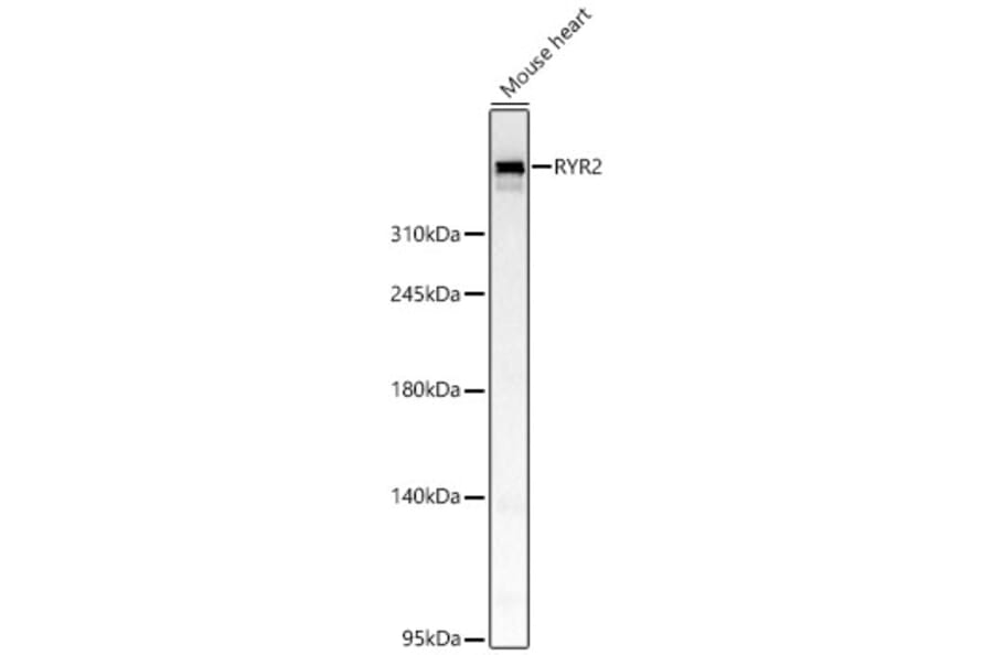 Western Blot - Anti-RYR2 Antibody (A329818) - Antibodies.com