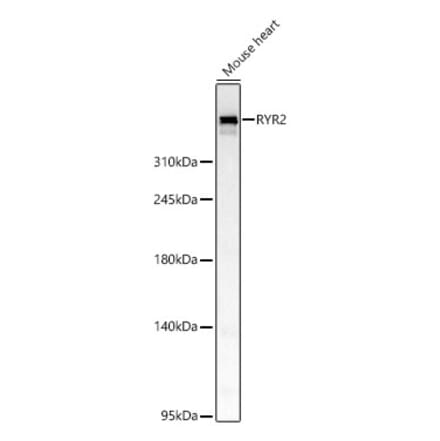 Western Blot - Anti-RYR2 Antibody (A329818) - Antibodies.com