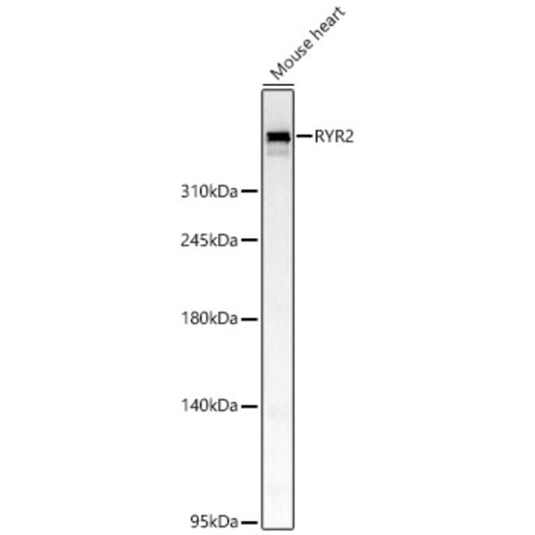 Western Blot - Anti-RYR2 Antibody (A329818) - Antibodies.com