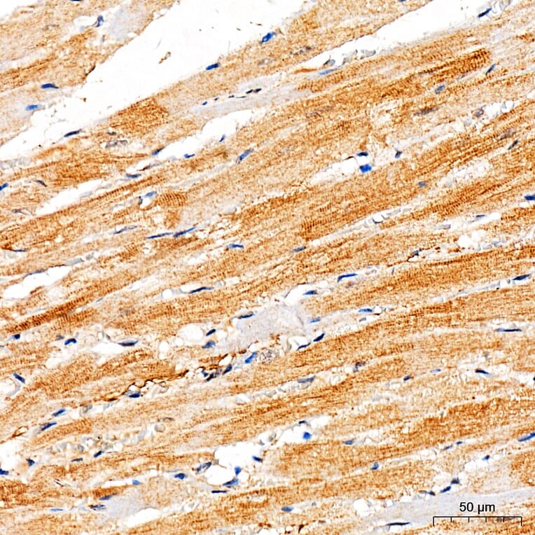 Immunohistochemistry - Anti-RYR2 Antibody (A329818) - Antibodies.com