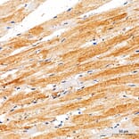Immunohistochemistry - Anti-RYR2 Antibody (A329818) - Antibodies.com
