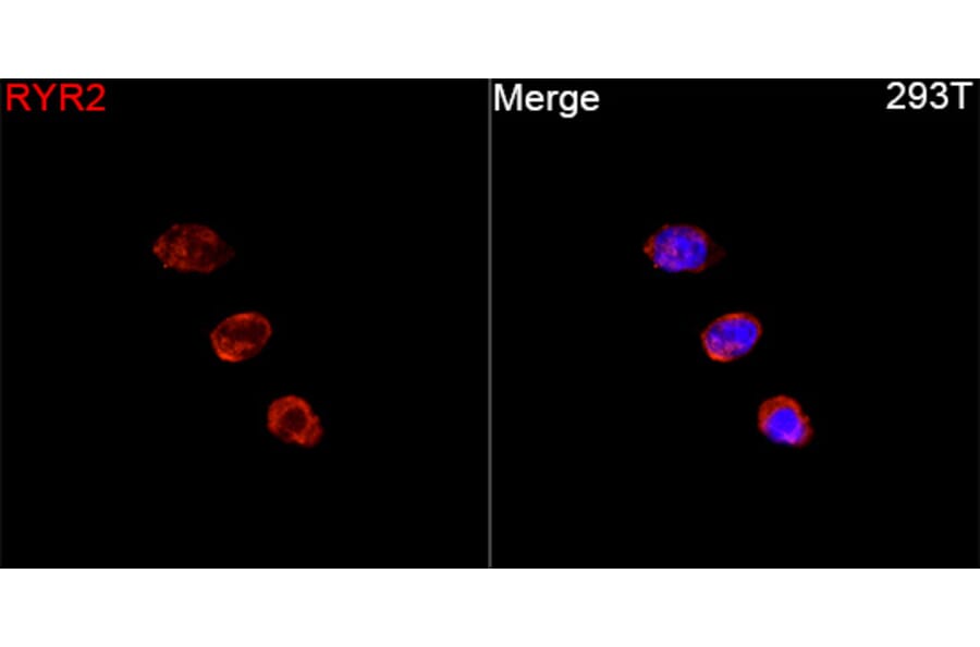 Immunofluorescence - Anti-RYR2 Antibody (A329818) - Antibodies.com