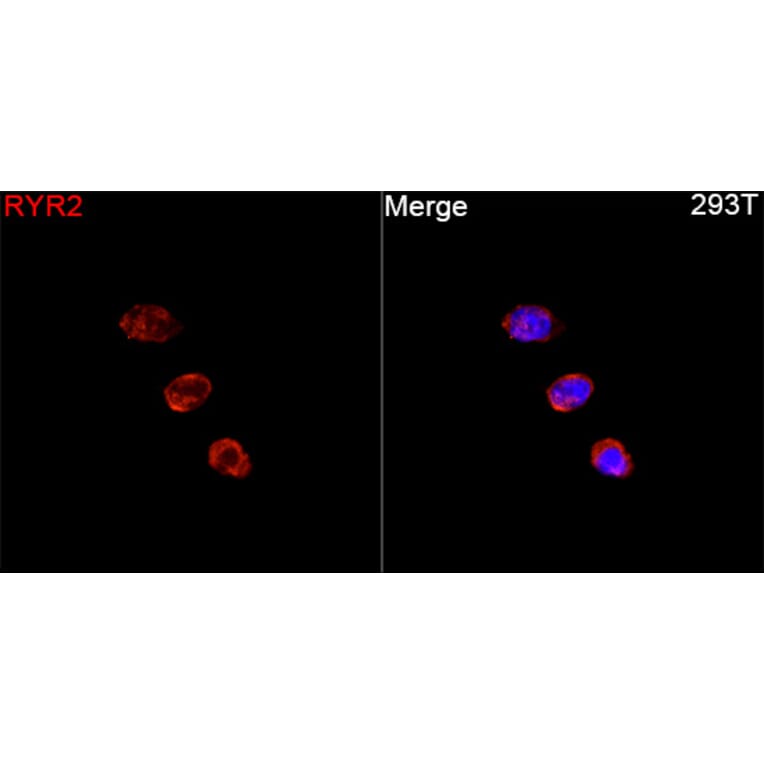Immunofluorescence - Anti-RYR2 Antibody (A329818) - Antibodies.com