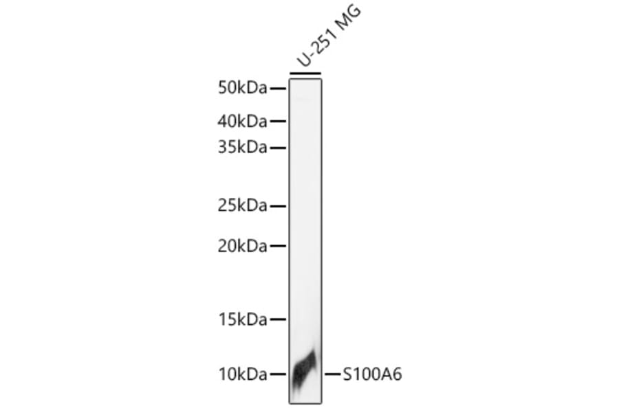 Western Blot - Anti-S100 alpha 6/PRA Antibody (A329819) - Antibodies.com