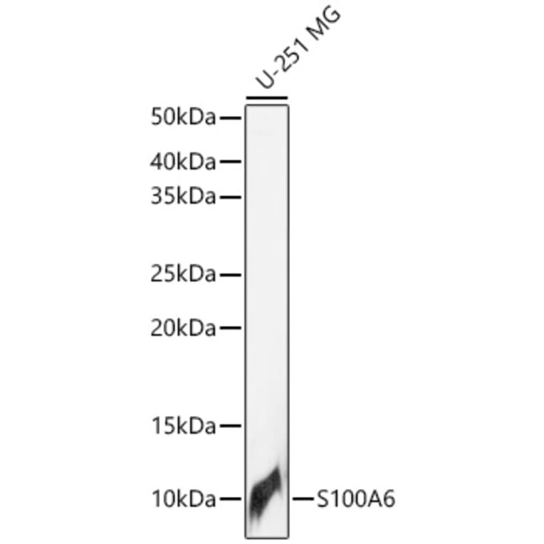 Western Blot - Anti-S100 alpha 6/PRA Antibody (A329819) - Antibodies.com