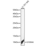 Western Blot - Anti-S100 alpha 6/PRA Antibody (A329819) - Antibodies.com