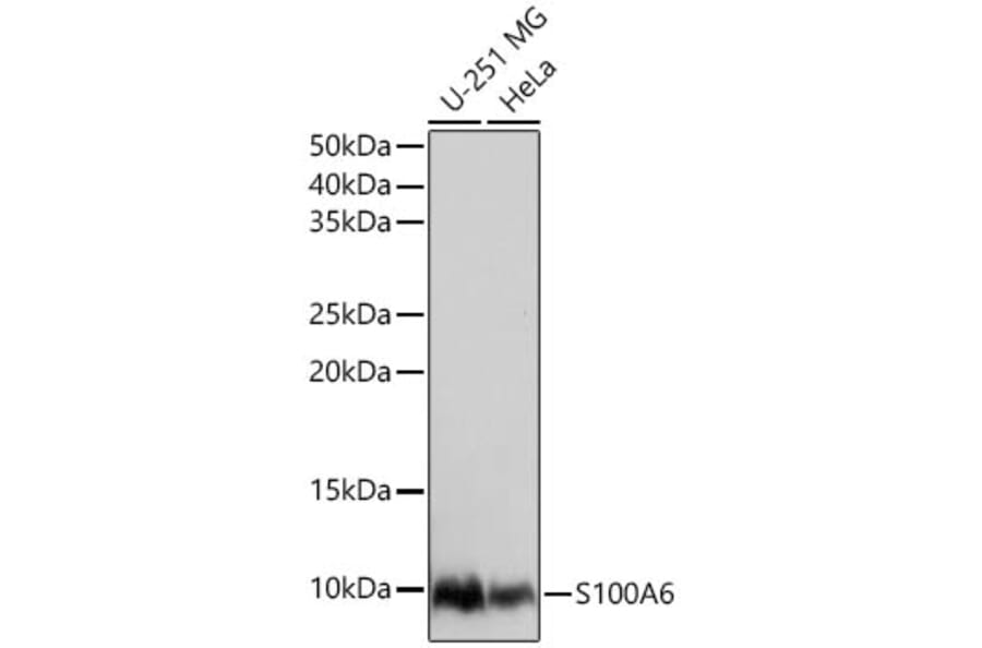 Western Blot - Anti-S100 alpha 6/PRA Antibody (A329819) - Antibodies.com