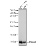 Western Blot - Anti-S100 alpha 6/PRA Antibody (A329819) - Antibodies.com