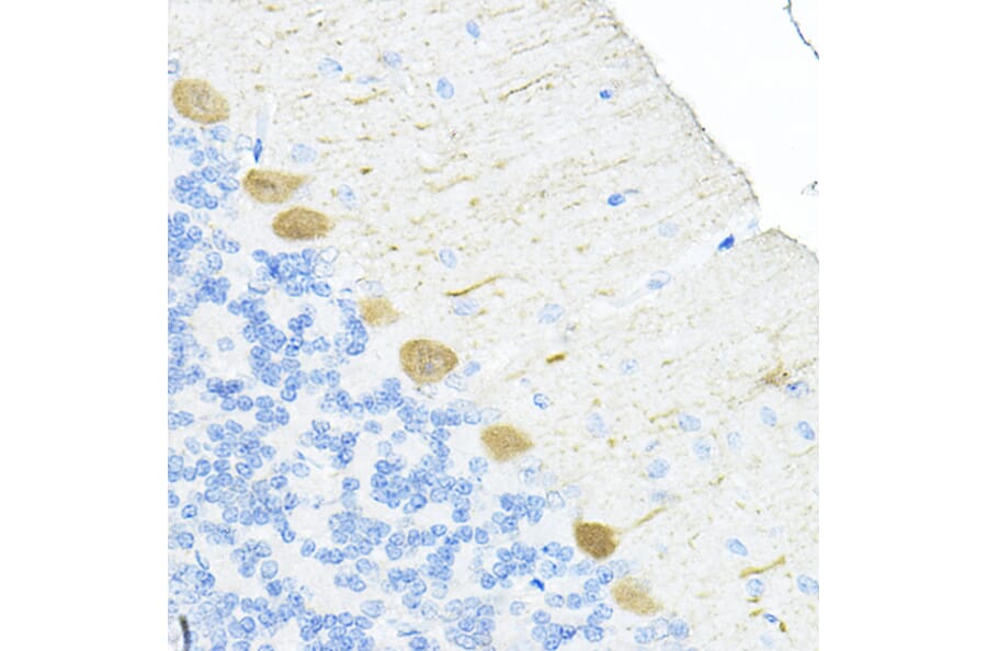 Immunohistochemistry - Anti-S100 alpha 6/PRA Antibody (A329819) - Antibodies.com