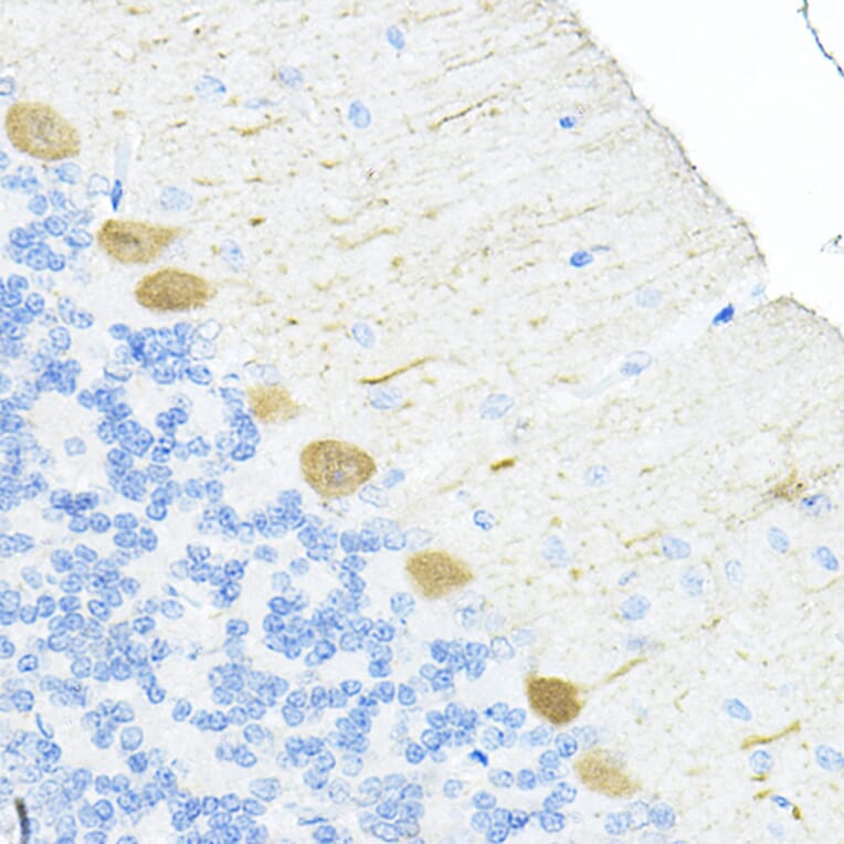 Immunohistochemistry - Anti-S100 alpha 6/PRA Antibody (A329819) - Antibodies.com
