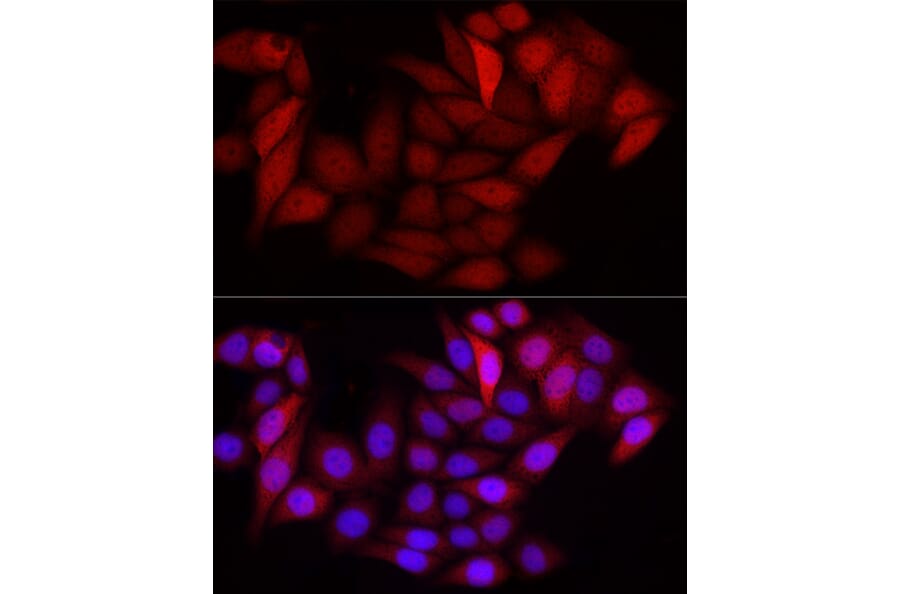 Immunofluorescence - Anti-S100 alpha 6/PRA Antibody (A329819) - Antibodies.com