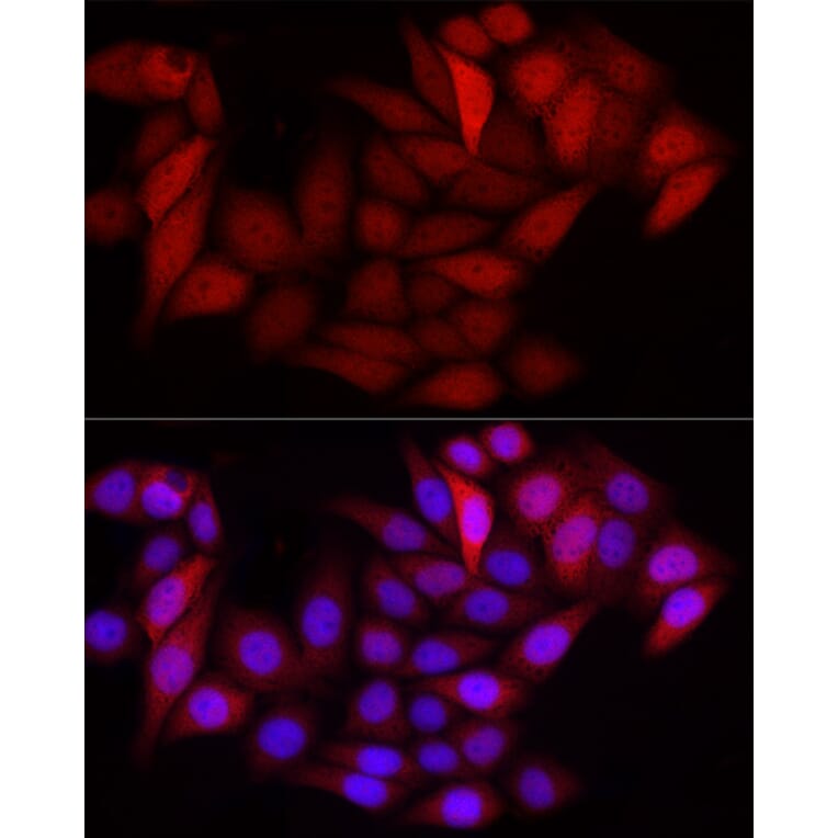 Immunofluorescence - Anti-S100 alpha 6/PRA Antibody (A329819) - Antibodies.com