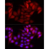 Immunofluorescence - Anti-S100 alpha 6/PRA Antibody (A329819) - Antibodies.com