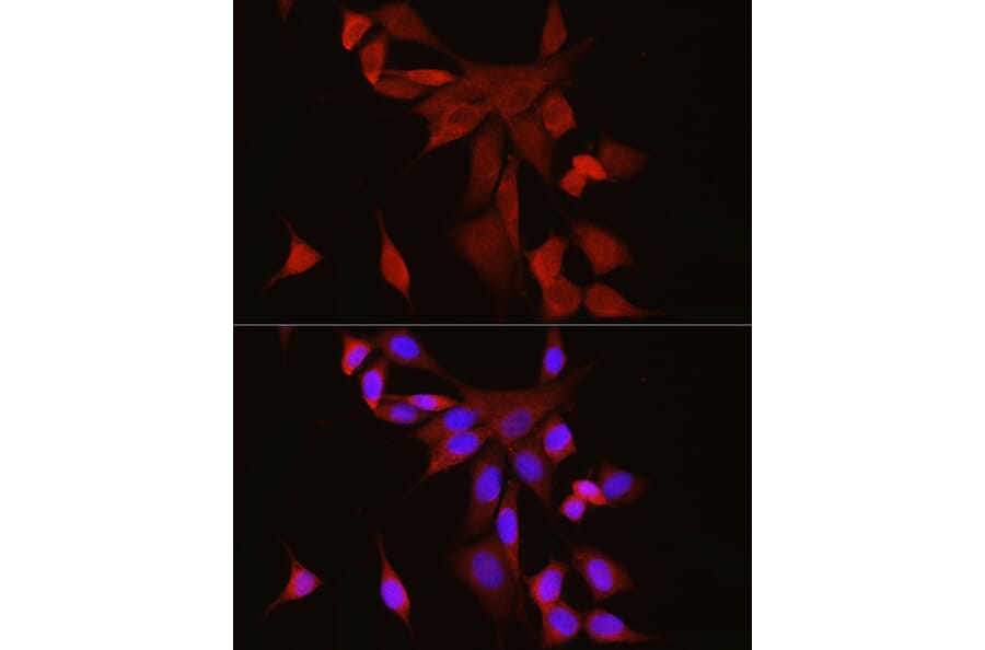 Immunofluorescence - Anti-S100 alpha 6/PRA Antibody (A329819) - Antibodies.com