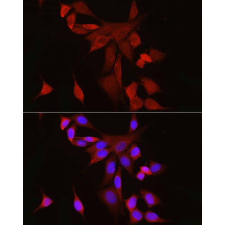 Immunofluorescence - Anti-S100 alpha 6/PRA Antibody (A329819) - Antibodies.com