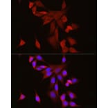 Immunofluorescence - Anti-S100 alpha 6/PRA Antibody (A329819) - Antibodies.com