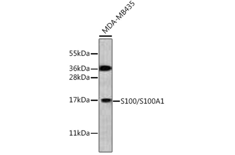 Western Blot - Anti-S100A1 Antibody (A329822) - Antibodies.com
