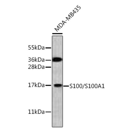 Western Blot - Anti-S100A1 Antibody (A329822) - Antibodies.com