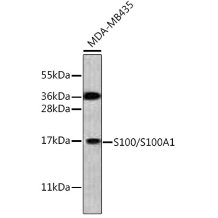 Western Blot - Anti-S100A1 Antibody (A329822) - Antibodies.com