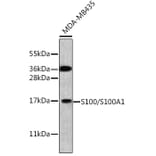 Western Blot - Anti-S100A1 Antibody (A329822) - Antibodies.com