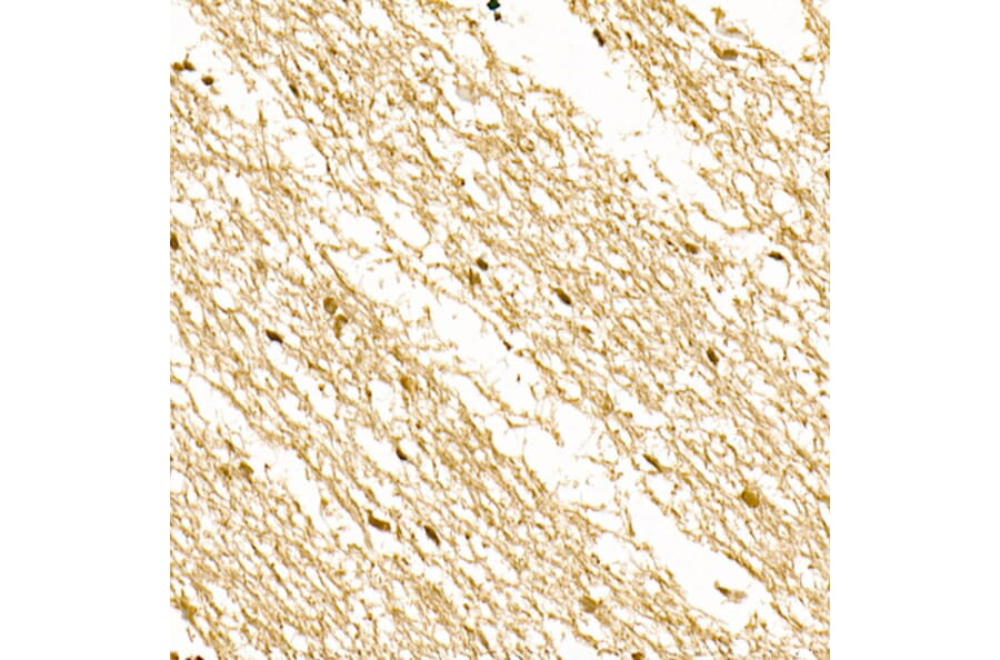 Immunohistochemistry - Anti-S100A1 Antibody (A329822) - Antibodies.com