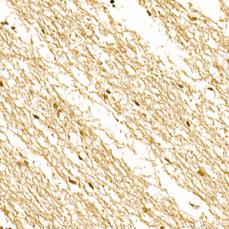 Immunohistochemistry - Anti-S100A1 Antibody (A329822) - Antibodies.com