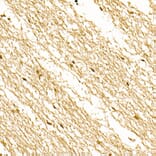 Immunohistochemistry - Anti-S100A1 Antibody (A329822) - Antibodies.com