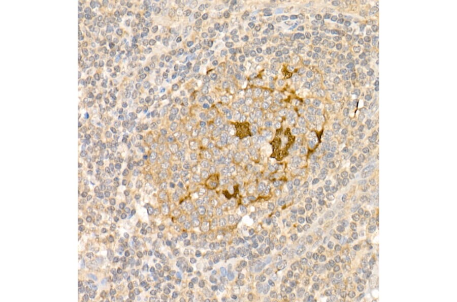 Immunohistochemistry - Anti-S100A1 Antibody (A329822) - Antibodies.com