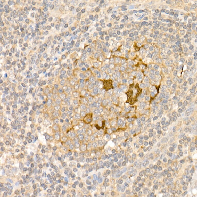 Immunohistochemistry - Anti-S100A1 Antibody (A329822) - Antibodies.com