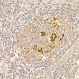 Immunohistochemistry - Anti-S100A1 Antibody (A329822) - Antibodies.com